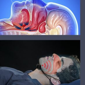 ca8a1b3f 5f3e 4378 8dc8 a6f58996c9f8